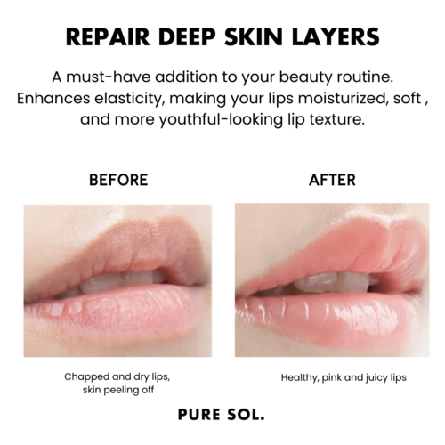PURE SOL. Beauty Pucker Up Baby Cherry Blossom Hydrogel Collagen Lip