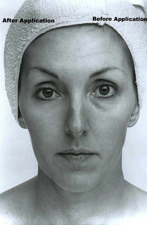 Collagen Lifting Facial Kit with Marli's EDA Revitalizing Moisturizer